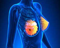 ماموگرافی و سونوگرافی در زنان دارای درد پستان