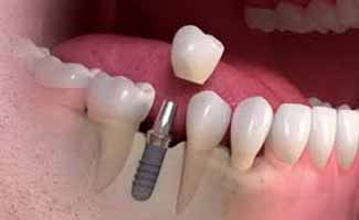 دندانپزشکی در آرارات