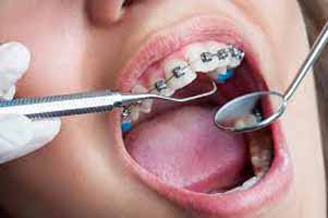 دندانپزشکی در اشكنان