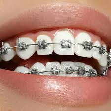 دندانپزشکی در باجگيران