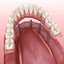 دندانپزشکی در برازجان