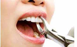 دندانپزشکی در بلورسازی