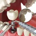 دندانپزشکی در بهبودی | دندانپزشک خوب در بهبودی | بهترین دندانپزشک در بهبودی | لیست بهترین دندانپزشکان در بهبودی | کلینیک و مطب دندانپزشکی