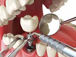 دندانپزشکی در بهبودی