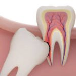 دندانپزشکی در بوعلی | دندانپزشک خوب در بوعلی | بهترین دندانپزشک در بوعلی | لیست بهترین دندانپزشکان در بوعلی | کلینیک و مطب دندانپزشکی بوعلی