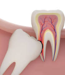 دندانپزشکی در بوعلی