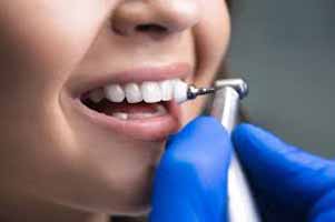 دندانپزشکی در تاکسیرانی