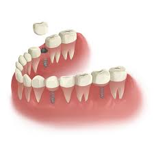 دندانپزشکی در تجریش