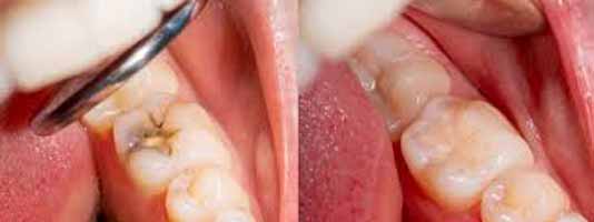 دندانپزشکی در تنكابن
