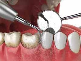 دندانپزشکی در توتكابن