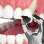 دندانپزشکی در توحید | دندانپزشک خوب در توحید | بهترین دندانپزشک در توحید | لیست بهترین دندانپزشکان در توحید | کلینیک و مطب دندانپزشکی