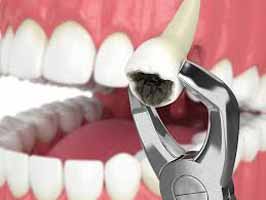 دندانپزشکی در توحید