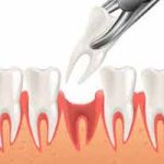 دندانپزشکی در تیموری | دندانپزشک خوب در تیموری | بهترین دندانپزشک در تیموری | لیست بهترین دندانپزشکان در تیموری | کلینیک و مطب دندانپزشکی