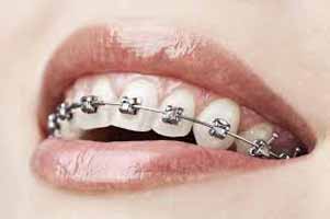 دندانپزشکی در حسينيه