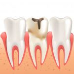 دندانپزشکی در خرم رودی | دندانپزشک خوب در خرم رودی | بهترین دندانپزشک در خرم رودی | لیست بهترین دندانپزشکان در خرم رودی | کلینیک دندانپزشکی