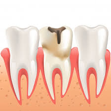 دندانپزشکی در خرم رودی