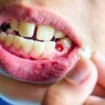 دندانپزشکی در خیابان زنجان | دندانپزشک خوب در خیابان زنجان | بهترین دندانپزشک در خیابان زنجان | لیست بهترین دندانپزشکان در خیابان زنجان