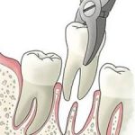 دندانپزشکی در دربند