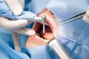 دندانپزشکی در دهاقان