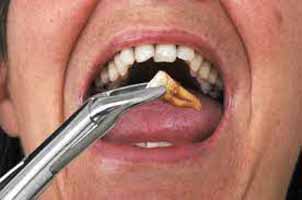 دندانپزشکی در دیباجی