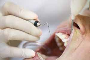 دندانپزشکی در رزن