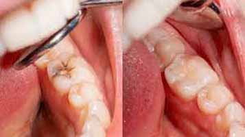 دندانپزشکی در رستمكلا