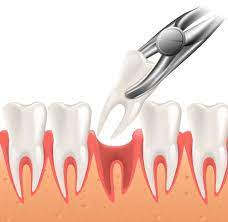 دندانپزشکی در رضی