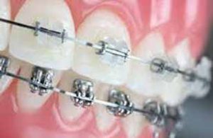 دندانپزشکی در سراب