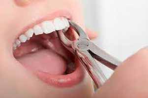 دندانپزشکی در سماله