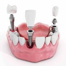 دندانپزشکی در سیزده آبان