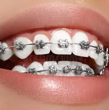 دندانپزشکی در شوقان