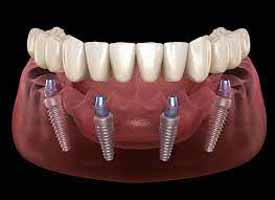 دندانپزشکی در صد دستگاه