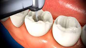دندانپزشکی در طاقانک
