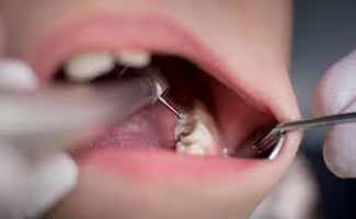 دندانپزشکی در غیوری