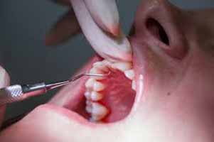 دندانپزشکی در فرحزاد