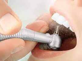 دندانپزشکی در فرسفج