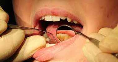 دندانپزشکی در لنده