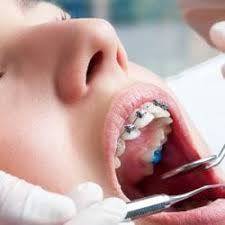 دندانپزشکی در ماكو