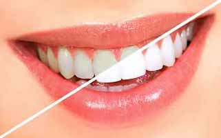دندانپزشکی در نالوس