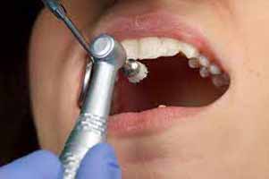 دندانپزشکی در نمين