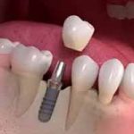 دندانپزشکی در نوبنیاد