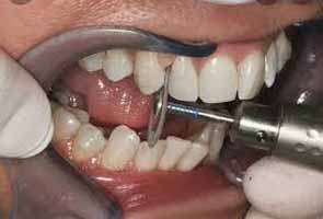 دندانپزشکی در هفت حوض