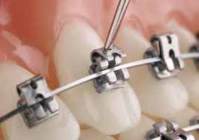 دندانپزشکی در وراوی