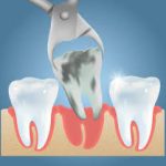 دندانپزشکی در پردیسان | دندانپزشک خوب در پردیسان | بهترین دندانپزشک در پردیسان | لیست بهترین دندانپزشکان در پردیسان | کلینیک دندانپزشکی