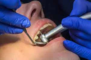 دندانپزشکی در پره سر