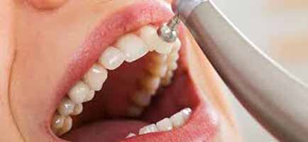 دندانپزشکی در چاف و چمخاله