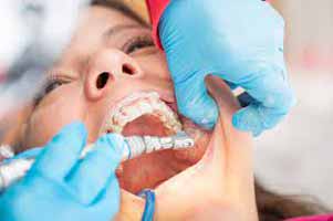 دندانپزشکی در چرمهين