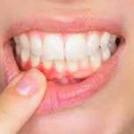 دندانپزشکی در چوب تراش | دندانپزشک خوب در چوب تراش | بهترین دندانپزشک در چوب تراش | لیست بهترین دندانپزشکان در چوب تراش | کلینیک دندانپزشکی