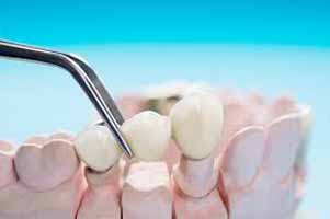 دندانپزشکی در چيتاب