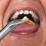 دندانپزشکی در کامرانیه